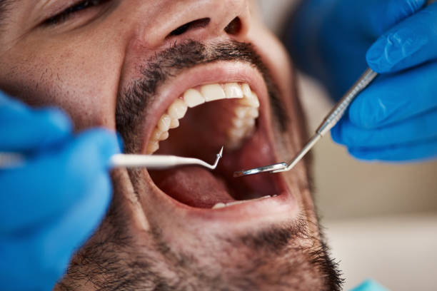 Best Walk-In Emergency Dentist in Stratford, CA